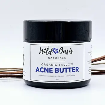 Acne Butter - Organic Tallow Acne Cream